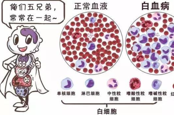 白血病的早期症状和前兆(儿童白血病早期七大症状)