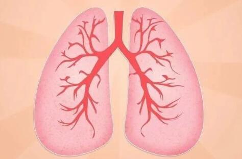 肺结核有哪些症状表现(老人肺结核症状及表现)